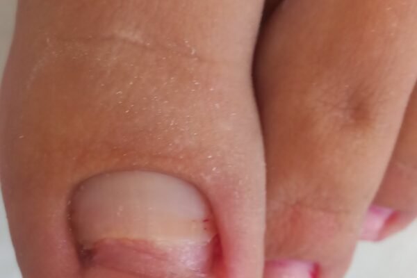 angel-claws_nails_podologia (19)