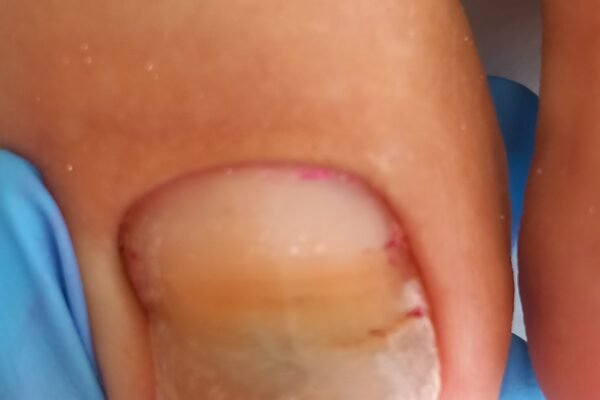 angel-claws_nails_podologia (20)