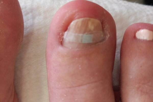 angel-claws_nails_podologia (4)