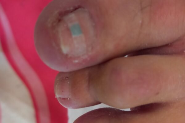 angel-claws_nails_podologia (7)