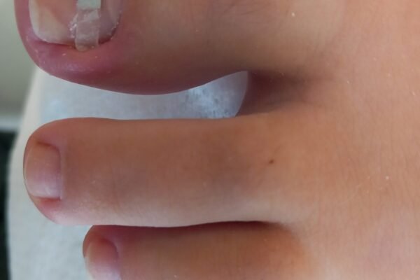 angel-claws_nails_podologia (8)